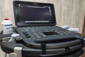 تجهیز بخش آی.سی.یو بیمارستان امام خمینی(ره) اهواز به دستگاه اکو سونوگرافی پرتابل